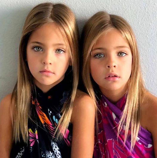 Identical twin girls born in 2010 have garnered global attention from an early age and are now renowned as the ‘Most Beautiful Twins in the World’