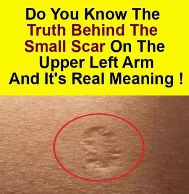 Do You Know The Real Significance Of The Small Scar On The Upper Left Arm