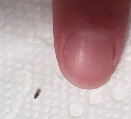 P3. If you find this bug in your hair, you must read this