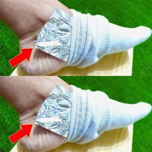 P3. Put Aluminum Foil on Your Feet and Say Goodbye to Aches and Pains: The Surprising Hack