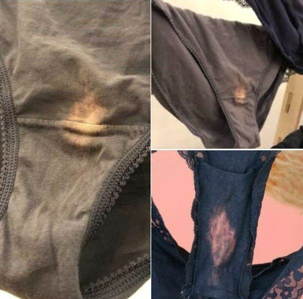 P3. This is what it means if you find a “bleach” spot on your underwear